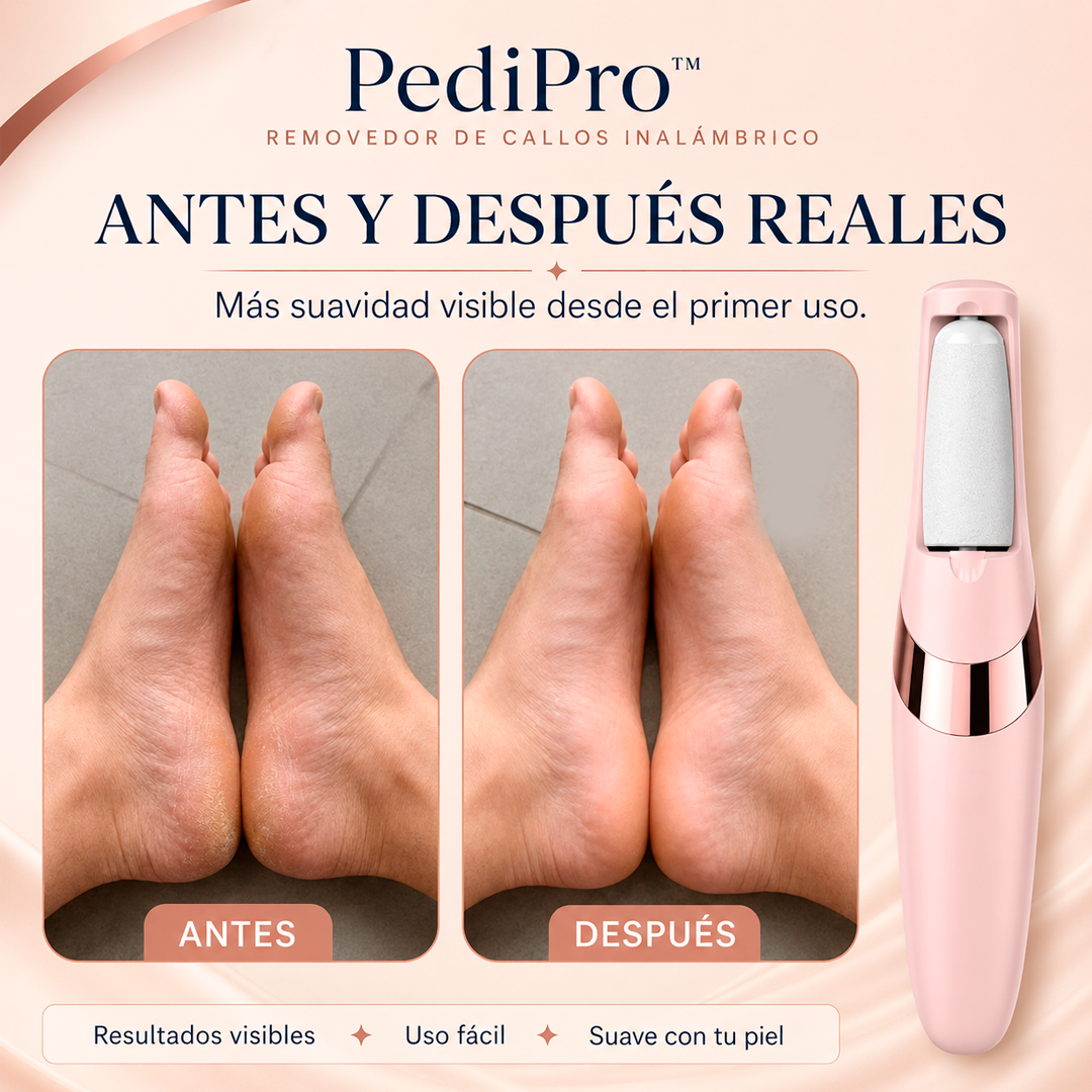 PediPro™ | Removedor de Callos Inalámbrico | Mostrá Tus Pies Sin Vergüenza