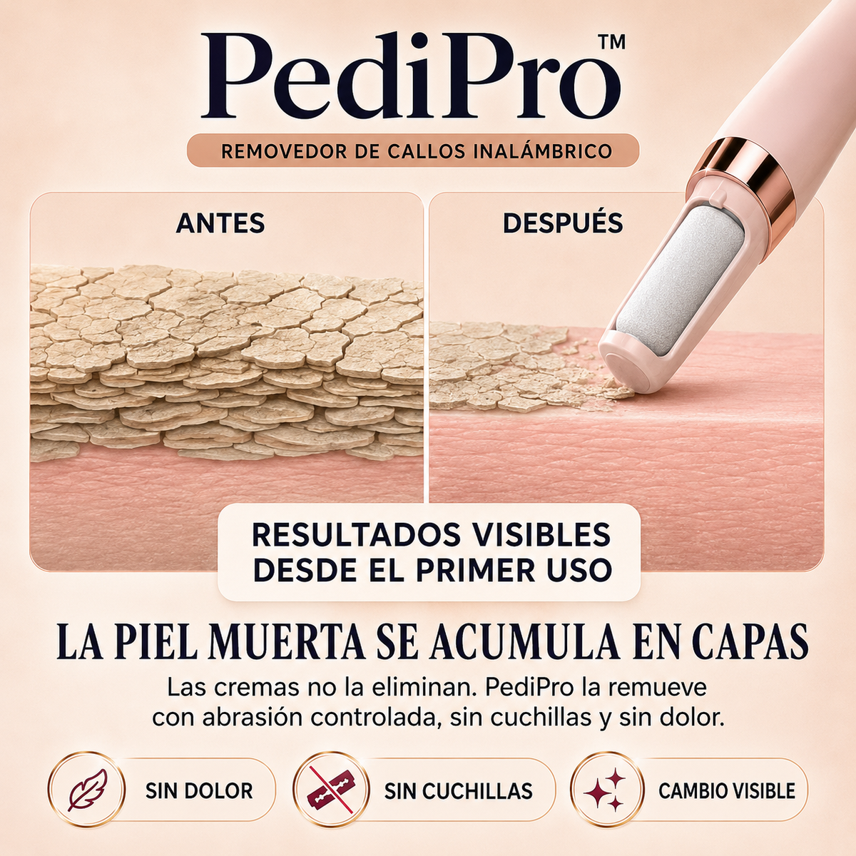 PediPro™ | Removedor de Callos Inalámbrico | Mostrá Tus Pies Sin Vergüenza