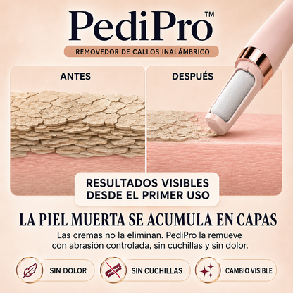 PediPro™ | Removedor de Callos Inalámbrico | Mostrá Tus Pies Sin Vergüenza